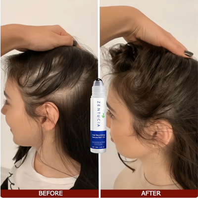 Hormonal Hair Growth Roll-On Serum
