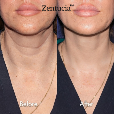 Zentucia™ Pure GHK Copper Peptide Serum