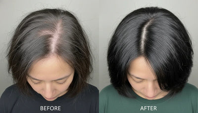 Hormonal Hair Growth Roll-On Serum